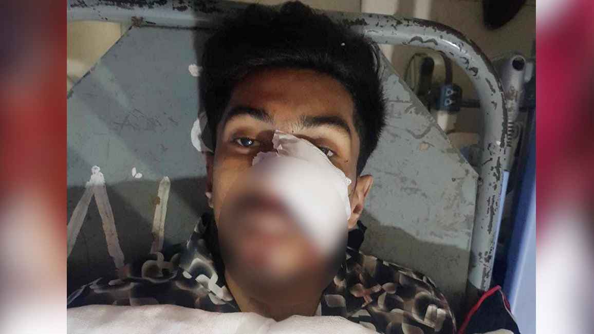 পল্লবীতে সন্ত্রাসী ‘ব্লেড বাবু’কে কুপিয়ে খুন